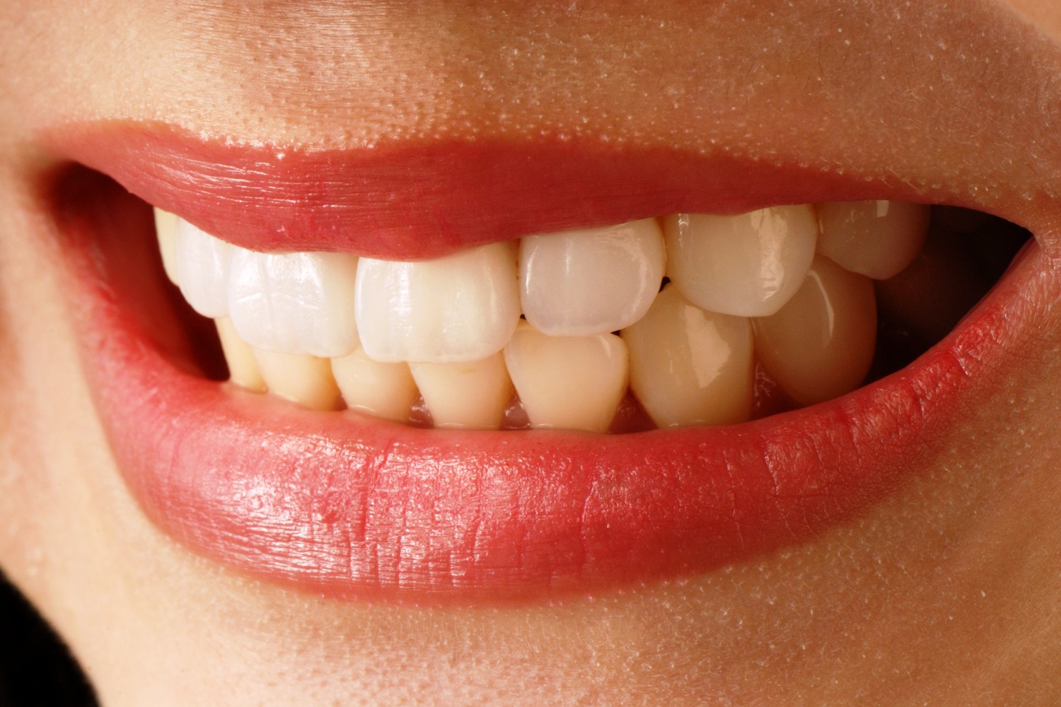 rock Arado Regeneración 5 señales de que necesitas una Limpieza Bucal – Clnica Dental Davos